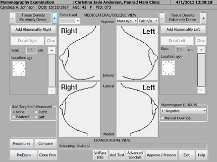 Volpara Screenshot